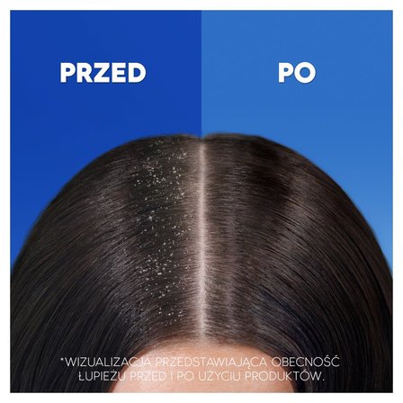 Head & Shoulders Citrus Fresh 2 w 1 Szampon przeciwłupieżowy z odżywką – usuwa do 100% łupieżu (4)