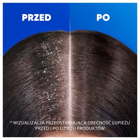 Head & Shoulders Ocean Fresh Codzienny Szampon Przeciwłupieżowy 400 ml. Każdy Typ Włosów (2)