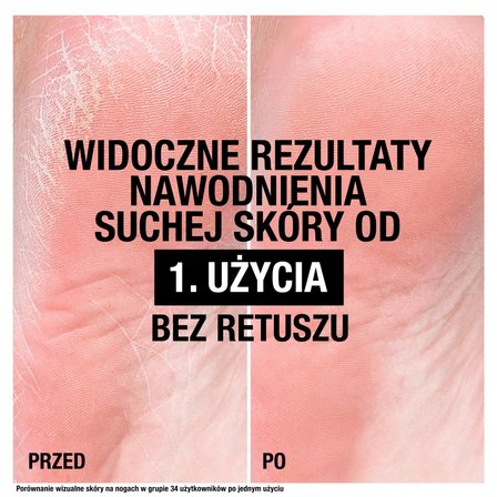 NEUTROGENA Krem do stóp na popękane pięty 50 ml (6)