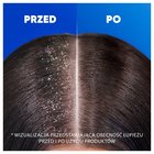 Head & Shoulders Dry Scalp Codzienny Szampon Przeciwłupieżowy 400 ml. Każdy Typ Włosów (2)